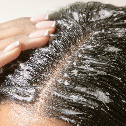 Exfoliante Capilar Gravvon