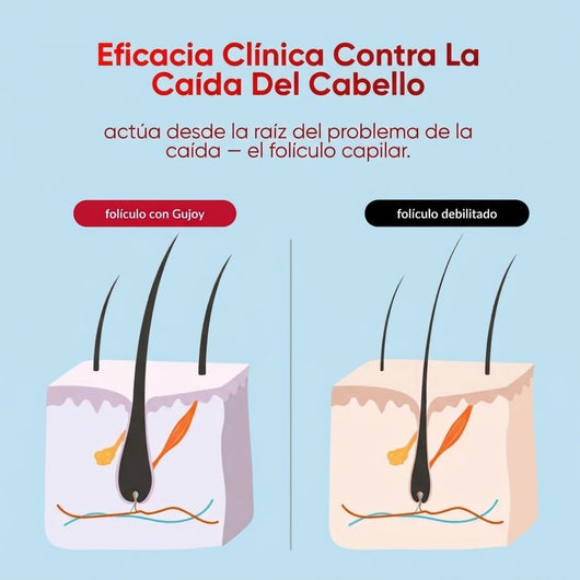 Hair Grow Gravvon La Solución Natural para la Caída y el Pelo Fino